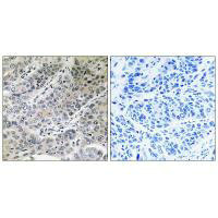 MPC2 Antibody
