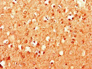MPDU1 Antibody