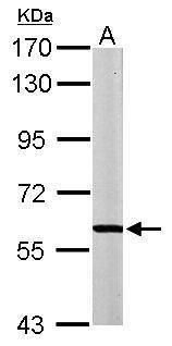 MPP2 Rabbit Polyclonal Antibody