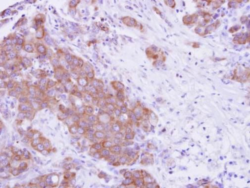 MPP3 antibody