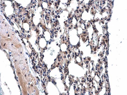 MPP3 antibody [N1C1]