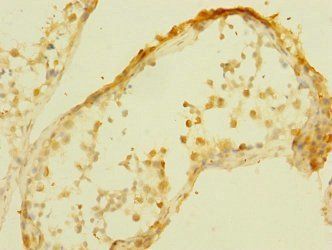MPP6 Antibody