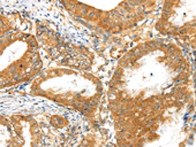MPP6 Antibody