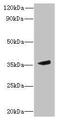 MPPED2 antibody