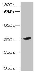 MPPED2 Antibody