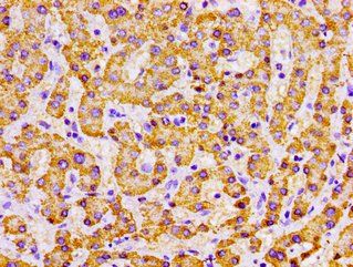 MPST Antibody