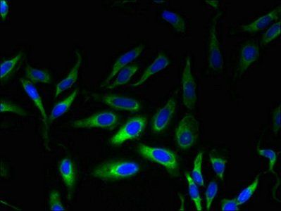 MPV17 Antibody