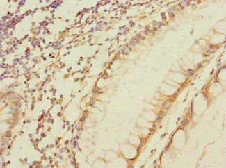 MPZL2 Antibody