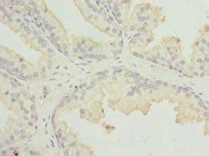 MR1 Antibody
