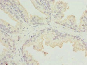 MR1 antibody