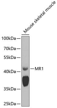 MR1 antibody