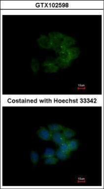 CDC42 binding protein kinase alpha Antibody