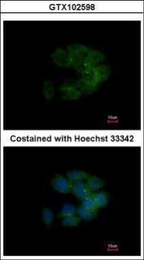 MRCK alpha antibody