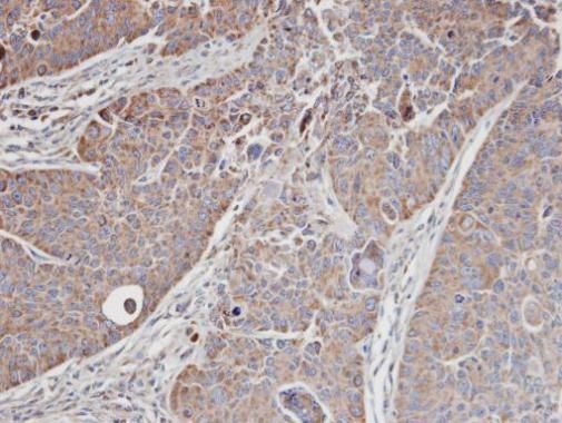 MRCK alpha Rabbit Polyclonal Antibody