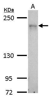 MRCK alpha Rabbit Polyclonal Antibody