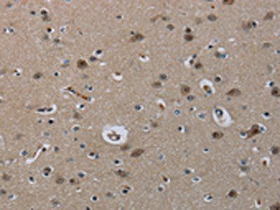 MRE11A Antibody