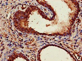 MRE11A Antibody