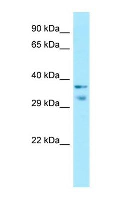 MRGPRX1 antibody