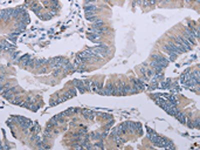 MRGPRX1 antibody