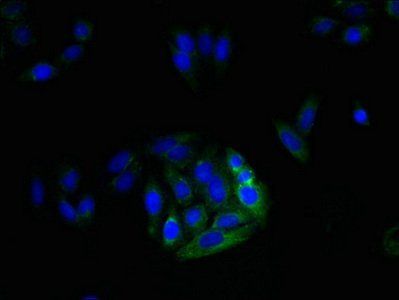 MRGPRX3 Antibody