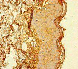 CYREN Antibody