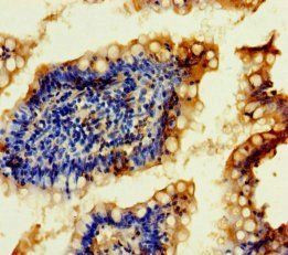 MRM2 Antibody