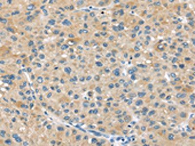 MRP 2 antibody