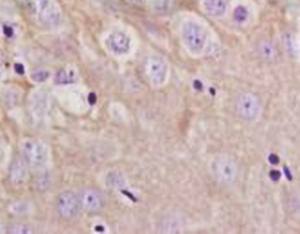 MRP5 Rabbit Polyclonal Antibody