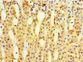 MRPL1 Antibody