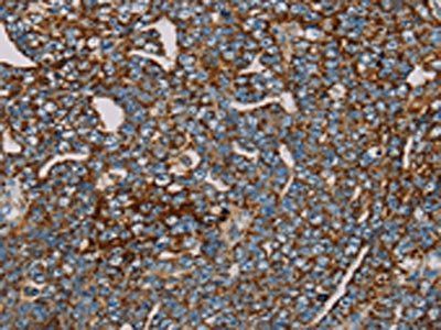 MRPL12 Antibody