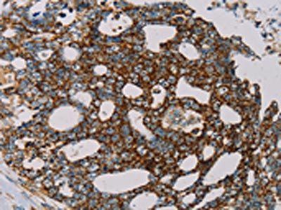 MRPL12 Antibody