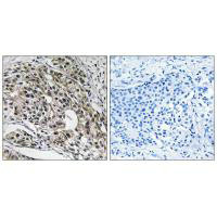 MRPL13 Antibody