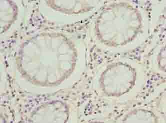 MRPL14 antibody