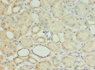 MRPL18 Antibody