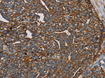 MRPL28 Antibody