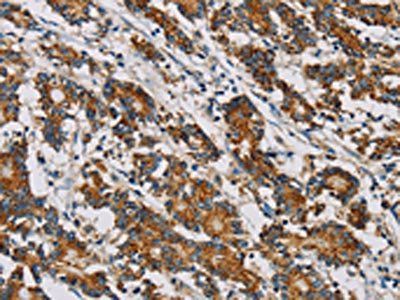 MRPL28 antibody