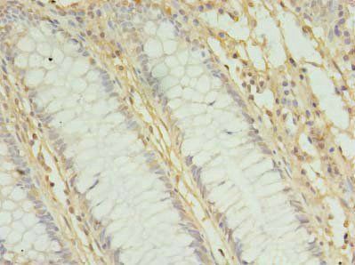 MRPL3 Antibody