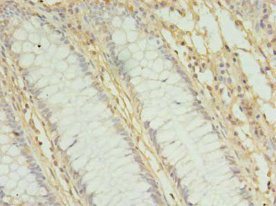 MRPL3 antibody