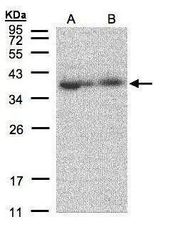 MRPL3 Rabbit Polyclonal Antibody