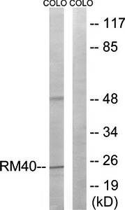 MRPL40 antibody