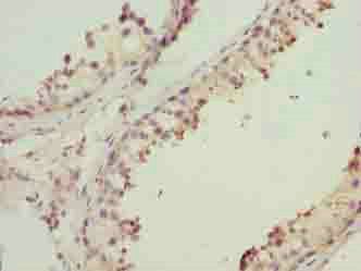 MRPL41 Antibody