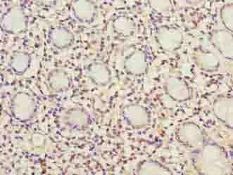 MRPL49 Antibody