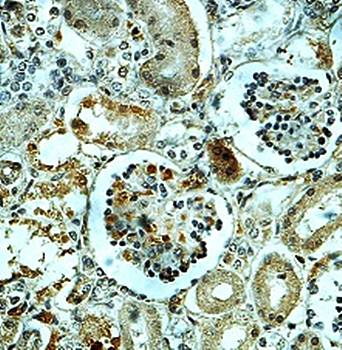 MRPP3 Rabbit Polyclonal Antibody