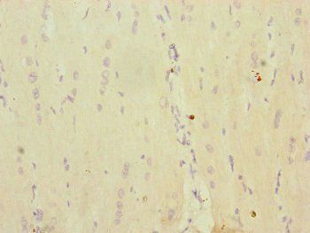 MRPS16 Antibody