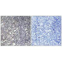 MRPS16 Antibody