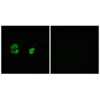 MRPS22 Antibody
