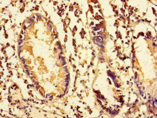 MRPS28 Antibody