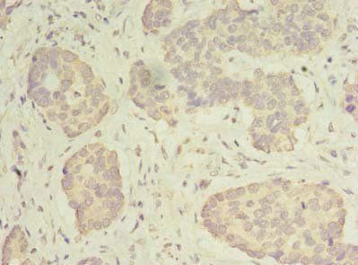 MRPS31 Antibody
