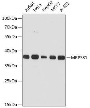 MRPS31 antibody