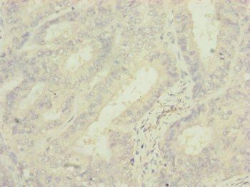 MRPS6 Antibody